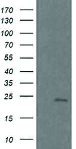 Anti-RAB21 Mouse Monoclonal Antibody [clone: OTI6G1]