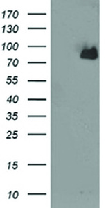 Anti-ACSS2 Mouse Monoclonal Antibody [clone: OTI2E1]