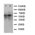 Western blot analysis of Lane 1: HELA Cell Lysate, Lane 2: MCF-7 Cell Lysate using E2F1 antibody