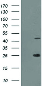 Anti-TASP1 Mouse Monoclonal Antibody [clone: OTI1C12]