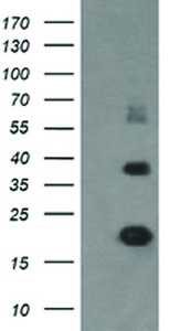 Anti-MCTS1 Mouse Monoclonal Antibody [clone: OTI2G2]