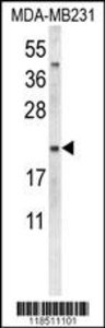 Anti-NEU1 Rabbit Polyclonal Antibody