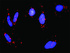 Anti-MAP3K3 + PRKACA Antibody Pair