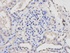 IHC-P staining of human kidney tissue using LCK antibody (primary antibody dilution at 1:100)