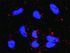 Anti-PTK2 + STAT3 Antibody Pair