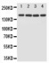 Anti-NMDAR2B Rabbit Polyclonal Antibody