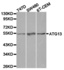 Western blot analysis of various cell lines using ATG13 antibody.