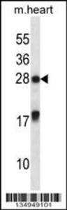 Anti-MXI1 Rabbit Polyclonal Antibody (AP (Alkaline Phosphatase))