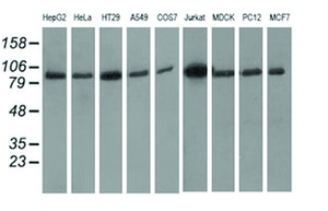 Anti-PRKD2 Mouse Monoclonal Antibody [clone: OTI3B12]