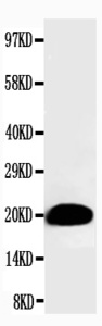 Anti-Myosin (Skeletal, Slow) Mouse Monoclonal Antibody [clone: IML-64]