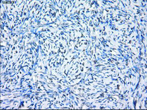 Anti-SLC7A8 Mouse Monoclonal Antibody [clone: OTI7D6]