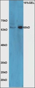 Western blot analysis of Mouse brain tissue (Line 1), Raji cell (Line 2) using NRG1 antibody.