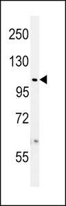 Anti-USP8 Rabbit Polyclonal Antibody (APC (Allophycocyanin))