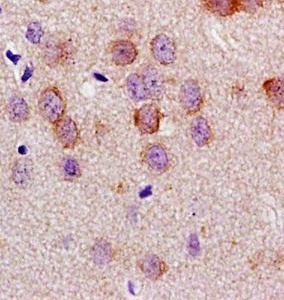 Immunohistochemical analysis of formalin fixed and paraffin embedded rat brain tissue using LLGL1 antibody