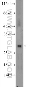 Anti-TTC32 Rabbit Polyclonal Antibody