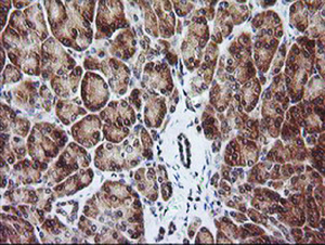 Anti-RIOK2 Mouse Monoclonal Antibody [clone: OTI3E11]