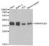 Western blot analysis of extracts of various cell lines using HNRNPA2B1 antibody