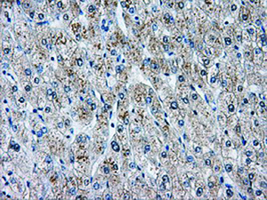 Anti-AKR1A1 Mouse Monoclonal Antibody [clone: OTI4G2]