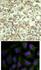 <lt/>b<gt/>Top Image:<lt/>/b<gt/> Immunohistochemical analysis of paraffin-embedded human breast carcinoma tissue using AKT1 (Phospho-Thr450).<lt/>b<gt/>Bottom Image:<lt/>/b<gt/> Immunofluorescence staining of methanol-fixed HeLa cells using AKT1 (phospho-Thr450).