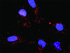 Anti-BUB1 + EIF4EBP1 Antibody Pair