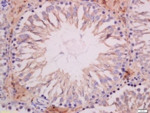 Immunohistochemical staining of rat testis tissue using SOAT1 antibody.