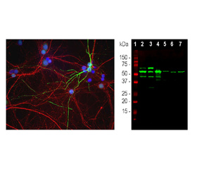 Left: Mixed neuron/glia cultures from newborn rat brain stained with rabbit antibody to peripherin (green) and phosphorylated NF-H (red) by ICC. Right: Western blot analysis of tissue and cell lysates.