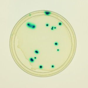 Ward's® Transduction of E.coli Lab Activity
