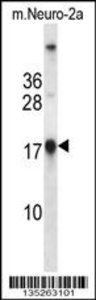 Anti-NME1 Rabbit Polyclonal Antibody (AP (Alkaline Phosphatase))