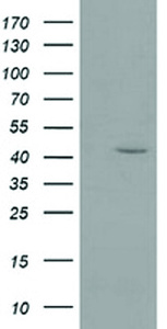 Anti-GMDS Mouse Monoclonal Antibody [clone: OTI2A1]