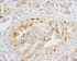 Anti-OPCML Rabbit Polyclonal Antibody
