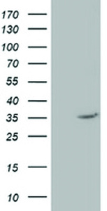 Anti-NUDT6 Mouse Monoclonal Antibody [clone: OTI10A9]
