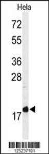 Anti-MMGT1 Rabbit Polyclonal Antibody (APC (Allophycocyanin))