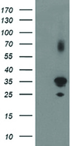 Anti-PLEKHA3 Mouse Monoclonal Antibody [clone: OTI5D11]
