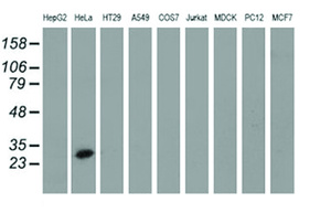 Anti-GSTT2 Mouse Monoclonal Antibody [clone: OTI4F9]