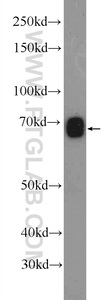 Anti-KIAA0907 Rabbit Polyclonal Antibody