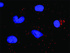 Anti-BCL2L1 + RAF1 Antibody Pair
