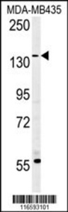 Anti-MUC1-T1224 Rabbit Polyclonal Antibody (FITC (Fluorescein Isothiocyanate))