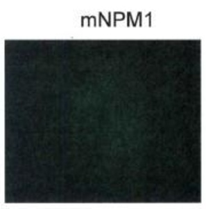 Anti-NPM1 Rabbit Polyclonal Antibody