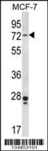 Anti-PAK4 Rabbit Polyclonal Antibody (PE (Phycoerythrin))