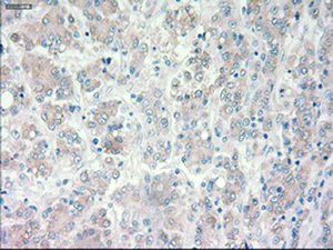 Anti-PROM2 Mouse Monoclonal Antibody [clone: OTI14D1]