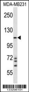 Anti-NLRC4 Rabbit Polyclonal Antibody (FITC (Fluorescein Isothiocyanate))