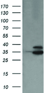 Anti-OTUB1 Mouse Monoclonal Antibody [clone: OTI1E3]