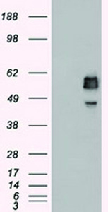 Anti-SSB Mouse Monoclonal Antibody [clone: OTI3F11]