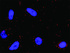 Anti-RET + MAPK1 Antibody Pair