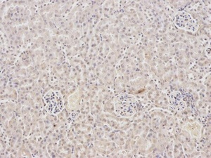 Immunohistochemical analysis of formalin-fixed and paraffin-embedded mouse kidney tissue using FABP2 antibody (primary antibody dilution at 1:100)