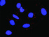 Anti-RPS6KA5 + EGF Antibody Pair