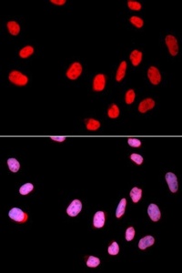 Immunofluorescense analysis of U2OS cell using CDC25C antibody