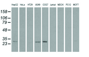 Anti-SPR Mouse Monoclonal Antibody [clone: OTI2F7]