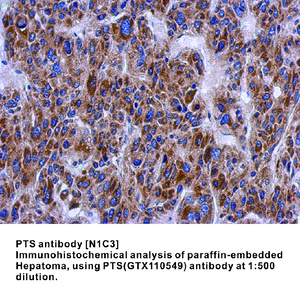 Anti-PTS Rabbit Polyclonal Antibody
