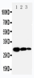 Anti-TIMP1 Rabbit Polyclonal Antibody